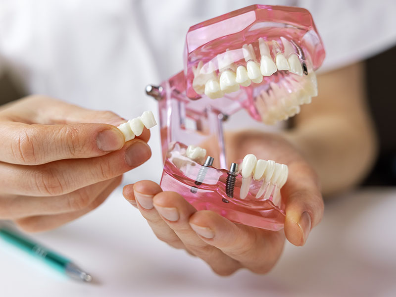 Emergency Dentist Bloomington